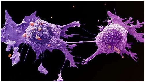 肺癌细胞